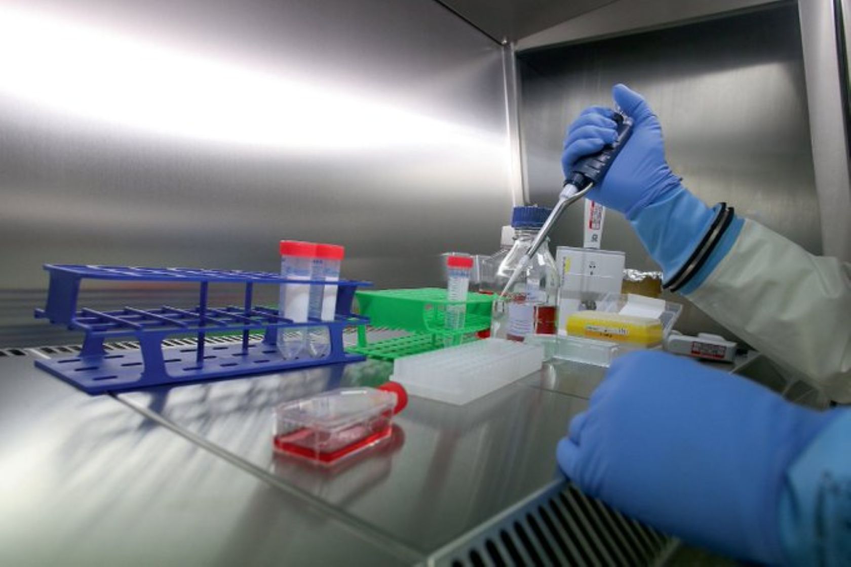 Una gota de sangre de la yema de un dedo podría servir para detectar el alzhéimer