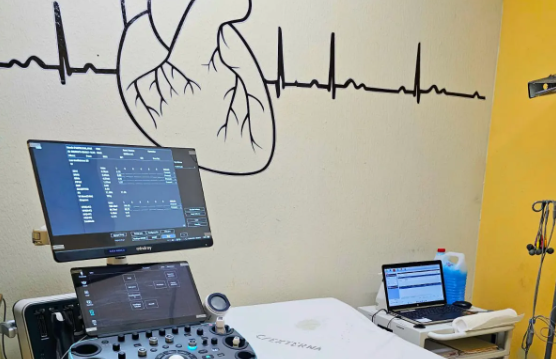 Hospital de San Benito refuerza la atención a la población con incorporación de ecocardiograma
